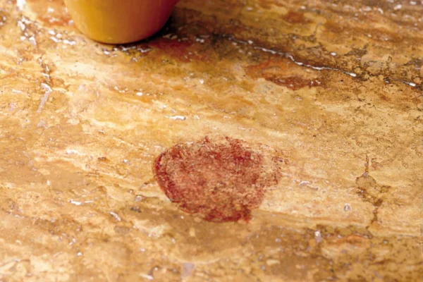 Stained Countertop Areas: Remove Marks Without Surface Damage
